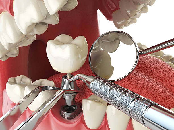 Best Tooth Pain Emergency Relief  in Clarksburg, MD